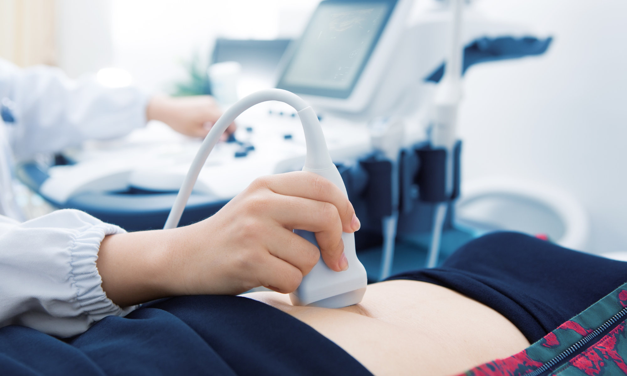 pregnancy ultrasound